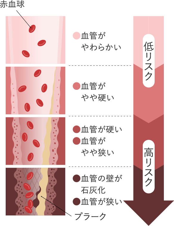 不健康な血管イメージの図